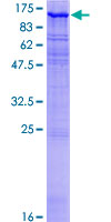 MAST205 / MAST2 Protein - 12.5% SDS-PAGE of human MAST2 stained with Coomassie Blue
