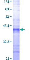 MAST205 / MAST2 Protein - 12.5% SDS-PAGE Stained with Coomassie Blue.