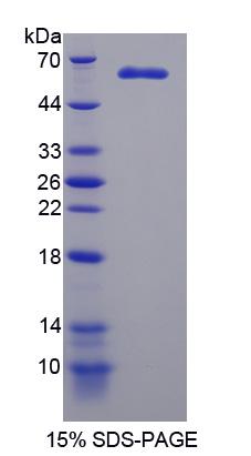 MAST205 / MAST2 Protein - Recombinant Microtubule Associated Serine/Threonine Kinase 2 By SDS-PAGE