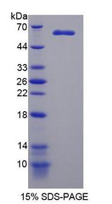 MAST205 / MAST2 Protein - Recombinant Microtubule Associated Serine/Threonine Kinase 2 By SDS-PAGE