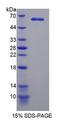 MAST205 / MAST2 Protein - Recombinant Microtubule Associated Serine/Threonine Kinase 2 By SDS-PAGE