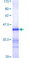 MAST3 Protein - 12.5% SDS-PAGE Stained with Coomassie Blue.