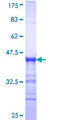 MAST4 Protein - 12.5% SDS-PAGE Stained with Coomassie Blue.