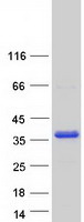 MAST4 Protein - Purified recombinant protein MAST4 was analyzed by SDS-PAGE gel and Coomassie Blue Staining