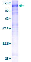 MASTL / GW Protein - 12.5% SDS-PAGE of human MASTL stained with Coomassie Blue