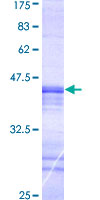 MASTL / GW Protein - 12.5% SDS-PAGE Stained with Coomassie Blue.