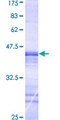 MASTL / GW Protein - 12.5% SDS-PAGE Stained with Coomassie Blue.
