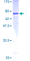 MAT / MAT1A Protein - 12.5% SDS-PAGE of human MAT1A stained with Coomassie Blue
