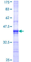 MAT / MAT1A Protein - 12.5% SDS-PAGE Stained with Coomassie Blue.