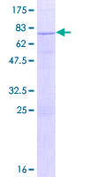 MAT2A Protein - 12.5% SDS-PAGE of human MAT2A stained with Coomassie Blue