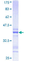 MAT2A Protein - 12.5% SDS-PAGE Stained with Coomassie Blue.