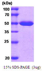 MAT2A Protein