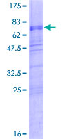 MATH2 / NEUROD6 Protein - 12.5% SDS-PAGE of human NEUROD6 stained with Coomassie Blue