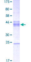 MATH2 / NEUROD6 Protein - 12.5% SDS-PAGE Stained with Coomassie Blue.