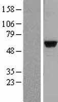 MATK Protein - Western validation with an anti-DDK antibody * L: Control HEK293 lysate R: Over-expression lysate