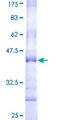 MATK Protein - 12.5% SDS-PAGE Stained with Coomassie Blue.