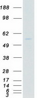 MATK Protein - Purified recombinant protein MATK was analyzed by SDS-PAGE gel and Coomassie Blue Staining