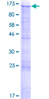 MATN2 / Matrilin 2 Protein - 12.5% SDS-PAGE of human MATN2 stained with Coomassie Blue