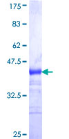 MATN2 / Matrilin 2 Protein - 12.5% SDS-PAGE Stained with Coomassie Blue.