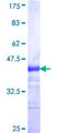 MATN2 / Matrilin 2 Protein - 12.5% SDS-PAGE Stained with Coomassie Blue.