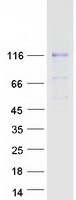 MATN2 / Matrilin 2 Protein - Purified recombinant protein MATN2 was analyzed by SDS-PAGE gel and Coomassie Blue Staining