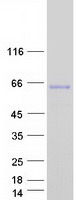 MATN3 / Matrilin 3 Protein - Purified recombinant protein MATN3 was analyzed by SDS-PAGE gel and Coomassie Blue Staining