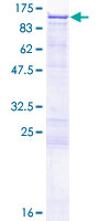 MATR3 / Matrin 3 Protein - 12.5% SDS-PAGE of human MATR3 stained with Coomassie Blue