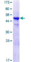 MAWDBP / PBLD Protein - 12.5% SDS-PAGE of human PBLD stained with Coomassie Blue