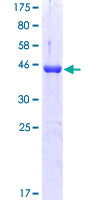 MAX Protein - 12.5% SDS-PAGE of human MAX stained with Coomassie Blue