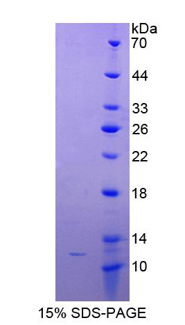 MAX Protein - Recombinant MYC Associated Factor X By SDS-PAGE