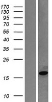 MB / Myoglobin Protein - Western validation with an anti-DDK antibody * L: Control HEK293 lysate R: Over-expression lysate