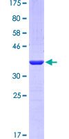MB / Myoglobin Protein - 12.5% SDS-PAGE Stained with Coomassie Blue.