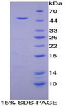 MB / Myoglobin Protein - Recombinant Myoglobin By SDS-PAGE