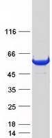 MB21D2 Protein - Purified recombinant protein MB21D2 was analyzed by SDS-PAGE gel and Coomassie Blue Staining