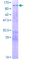 MBD1 Protein - 12.5% SDS-PAGE of human MBD1 stained with Coomassie Blue