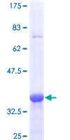 MBD1 Protein - 12.5% SDS-PAGE Stained with Coomassie Blue.