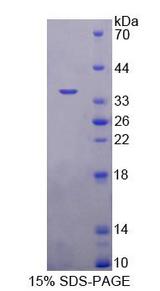 MBD2 Protein - Recombinant  Methyl CpG Binding Domain Protein 2 By SDS-PAGE