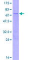 MBD3 Protein - 12.5% SDS-PAGE of human MBD3 stained with Coomassie Blue
