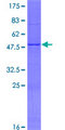 MBD3L1 Protein - 12.5% SDS-PAGE of human MBD3L1 stained with Coomassie Blue