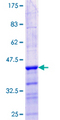 MBD3L1 Protein - 12.5% SDS-PAGE Stained with Coomassie Blue.