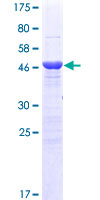 MBD5 Protein - 12.5% SDS-PAGE of human MBD5 stained with Coomassie Blue