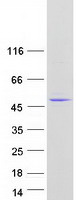 MBIP Protein - Purified recombinant protein MBIP was analyzed by SDS-PAGE gel and Coomassie Blue Staining