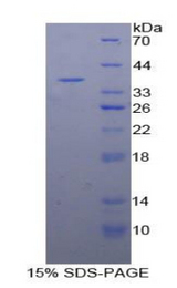 MBL2 / Mannose Binding Protein Protein - Recombinant Mannose Binding Lectin By SDS-PAGE