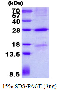 MBL2 / Mannose Binding Protein Protein