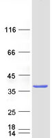 MBLAC2 Protein - Purified recombinant protein MBLAC2 was analyzed by SDS-PAGE gel and Coomassie Blue Staining