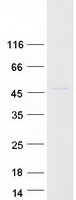 MBNL1 / MBNL Protein - Purified recombinant protein MBNL1 was analyzed by SDS-PAGE gel and Coomassie Blue Staining