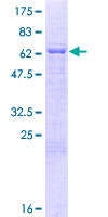 MBNL2 Protein - 12.5% SDS-PAGE of human MBNL2 stained with Coomassie Blue