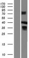 MBNL3 Protein - Western validation with an anti-DDK antibody * L: Control HEK293 lysate R: Over-expression lysate