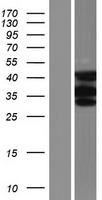 MBNL3 Protein - Western validation with an anti-DDK antibody * L: Control HEK293 lysate R: Over-expression lysate