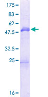 MBNL3 Protein - 12.5% SDS-PAGE of human MBNL3 stained with Coomassie Blue